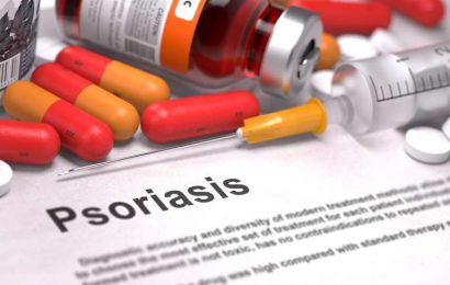 Psoriasis Causes, Types & Treatments – Learn Everything About Psoriasis